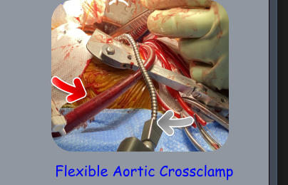 Flexible Aortic Crossclamp